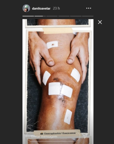 O joelho operado de Danilo Avelar. Foto: Reprodução Instagram
central do timão